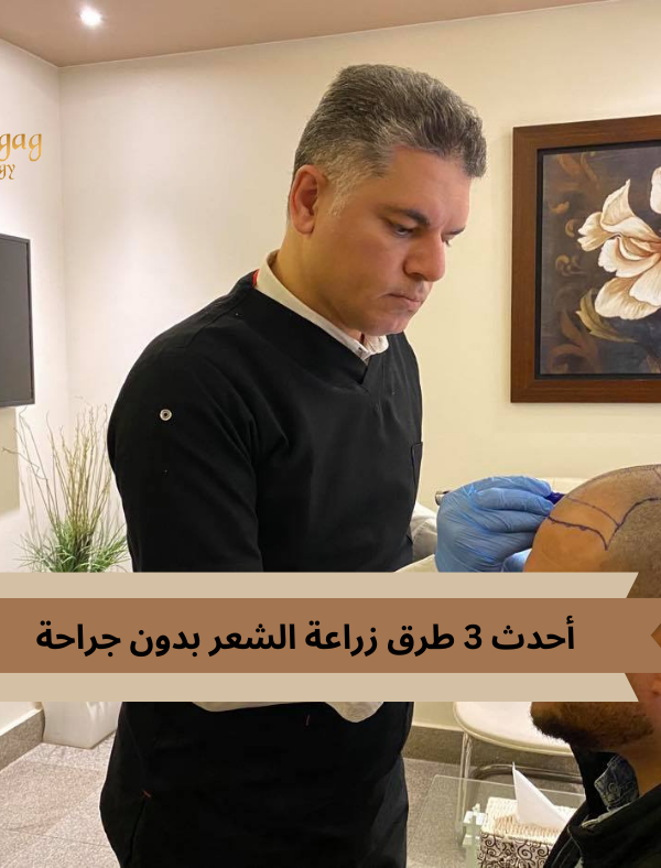 أحدث طرق زراعة الشعر بدون جراحة