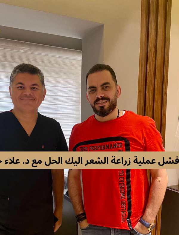 اسباب فشل عملية زراعة الشعر