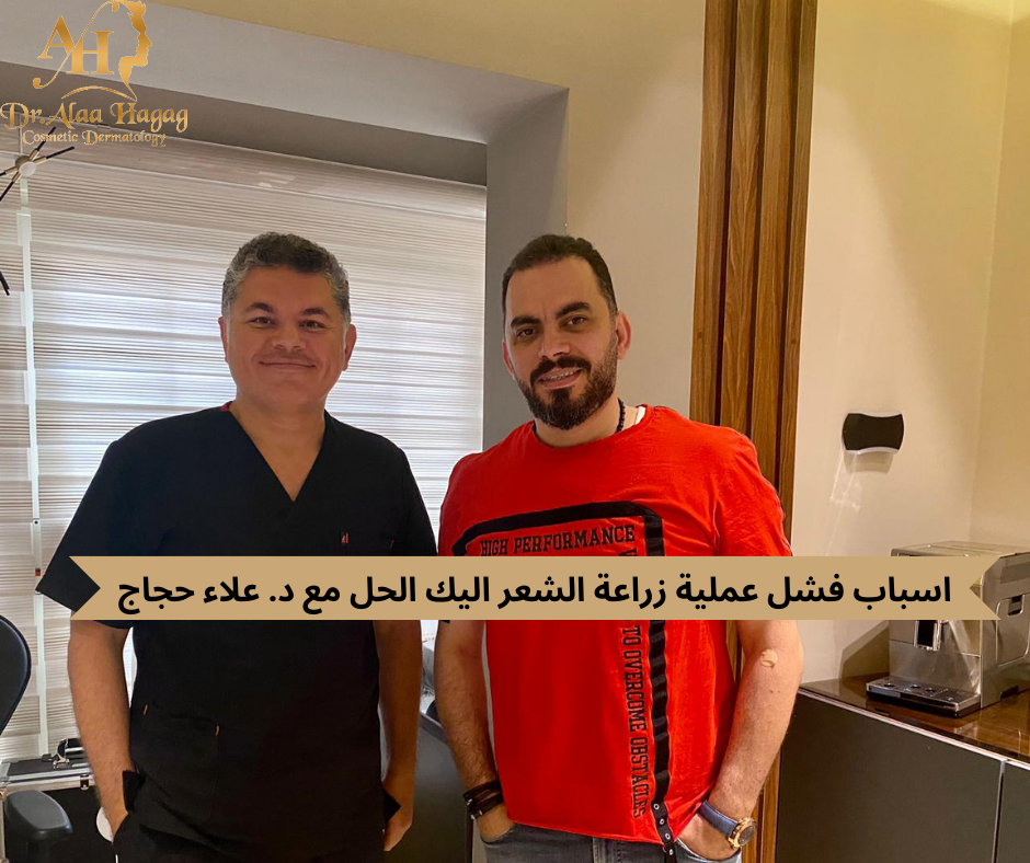 اسباب فشل عملية زراعة الشعر