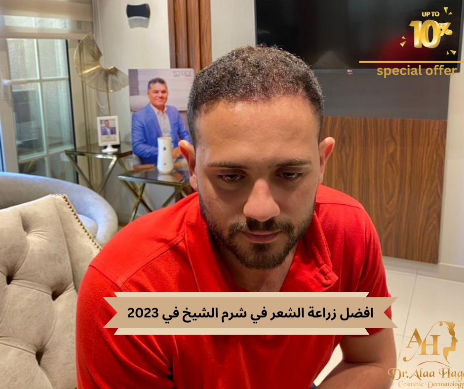 زراعة الشعر في شرم الشيخ