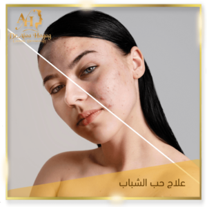 أفضل دكتور جلدية في مصر الجديدة