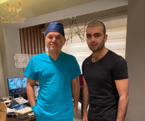 هل زراعة الشعر مكلفة
