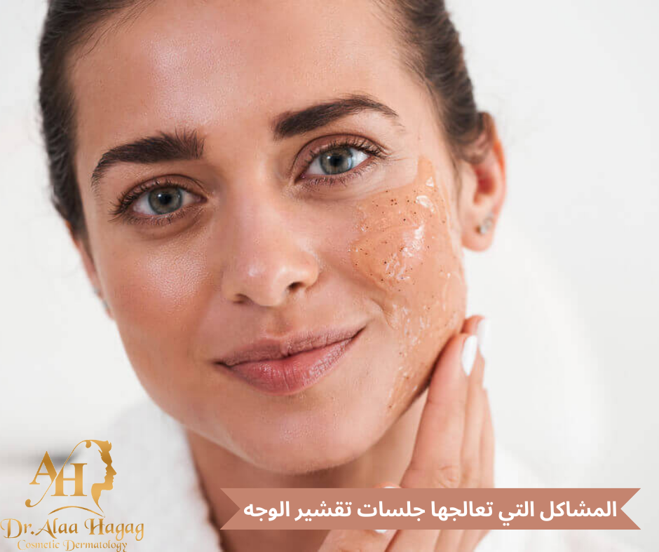 جلسات تقشير الوجه