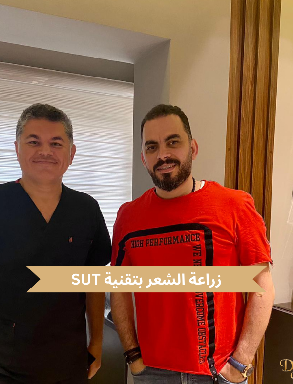 زراعة الشعر بتقنية SUT