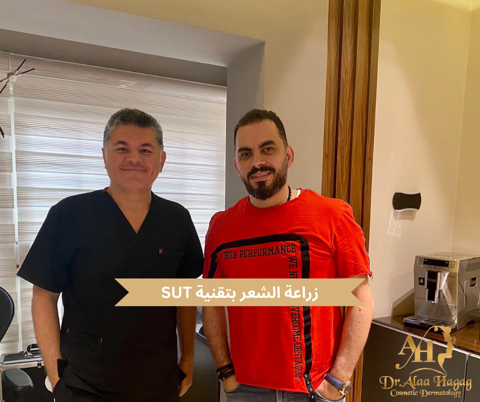 زراعة الشعر بتقنية SUT