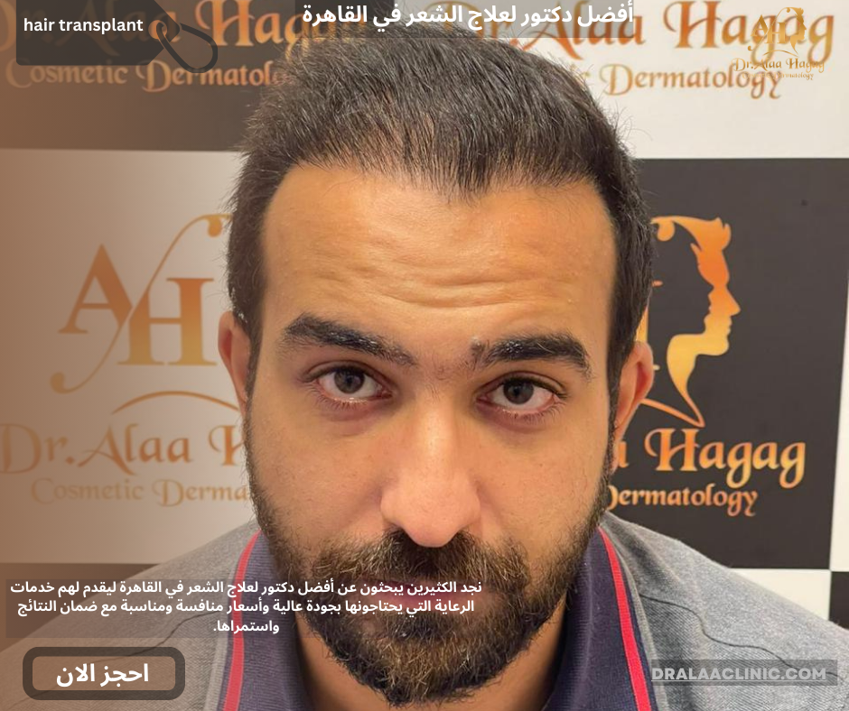 أفضل دكتور لعلاج الشعر في القاهرة