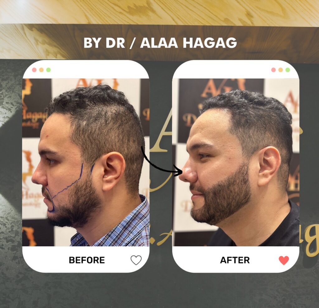 أفضل دكتور لعلاج الشعر في القاهرة