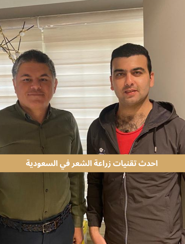 زراعة الشعر في السعودية