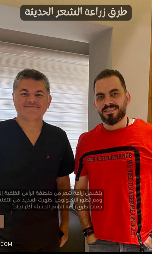طرق زراعة الشعر الحديثة
