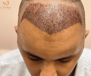 تصغير الجبهة