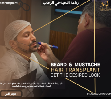 زراعة اللحية في الرحاب