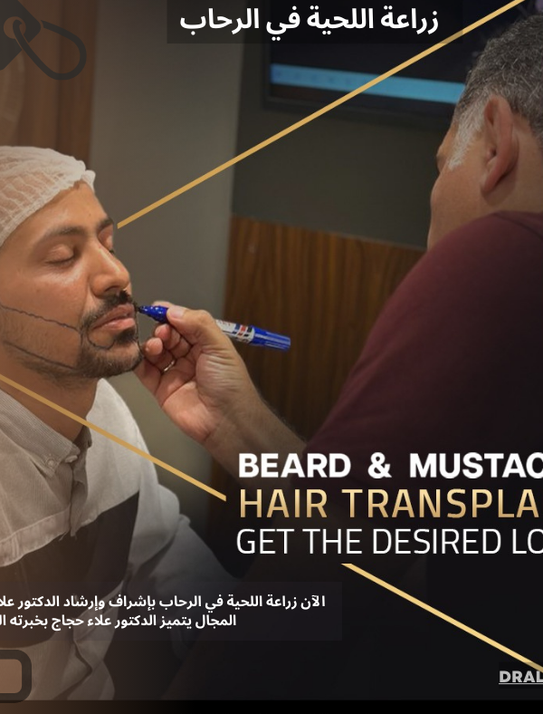 زراعة اللحية في الرحاب