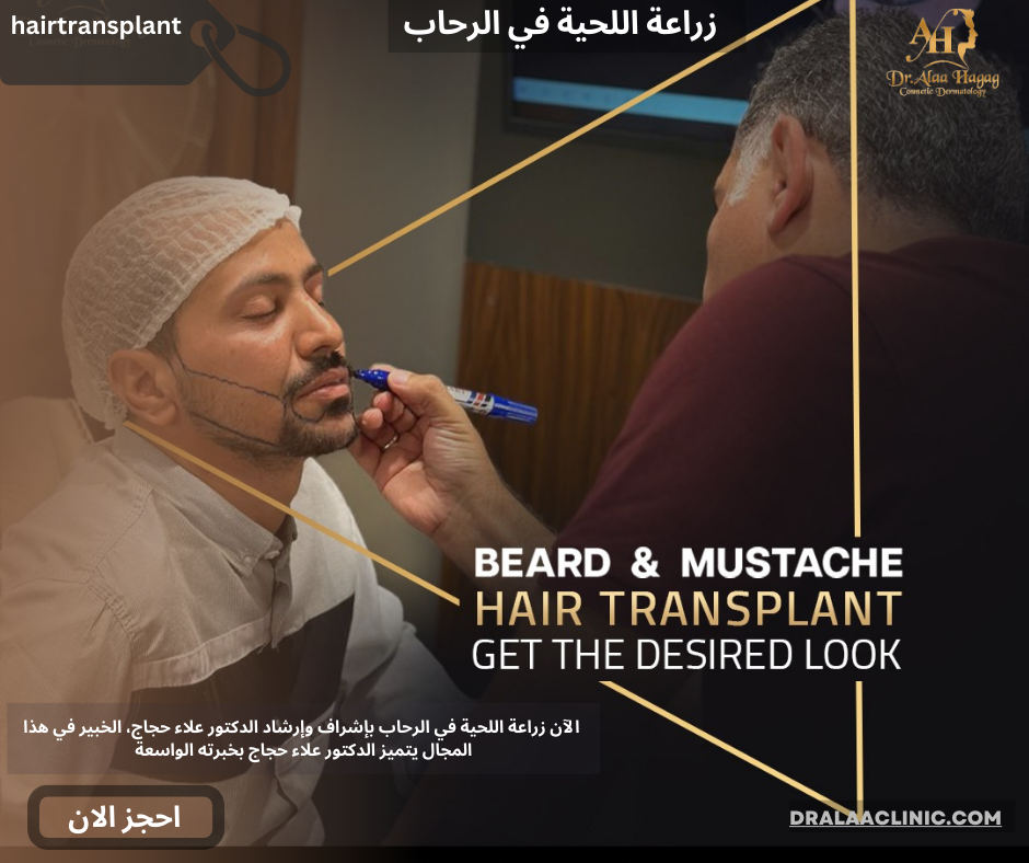 زراعة اللحية في الرحاب