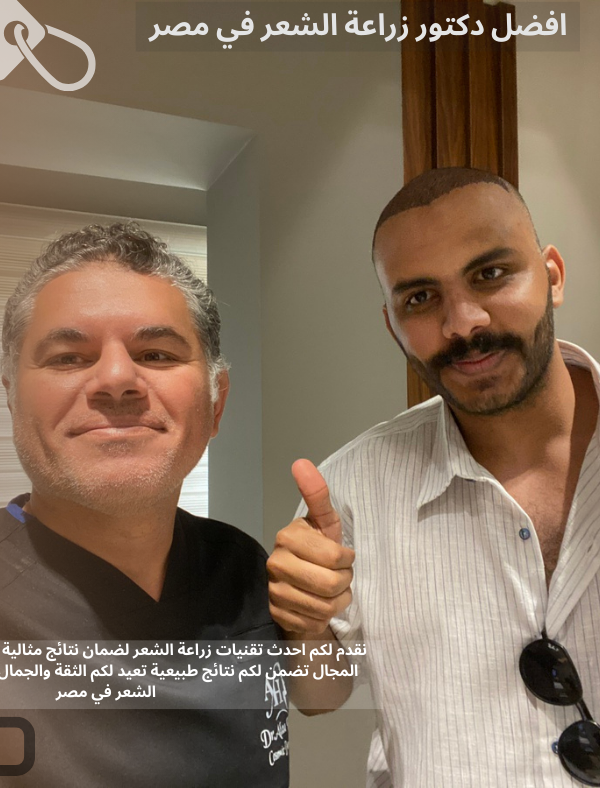 افضل دكتور زراعة الشعر في مصر