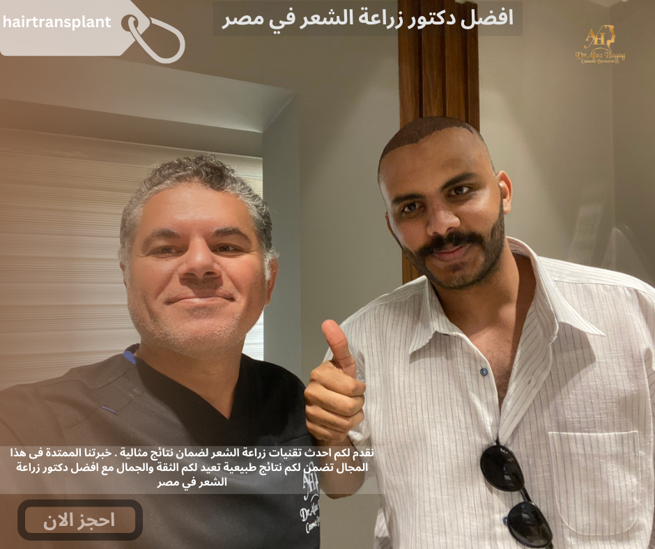 افضل دكتور زراعة الشعر في مصر