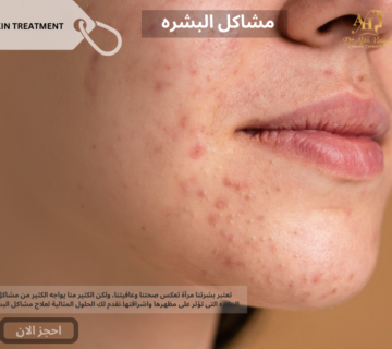 مشاكل البشره