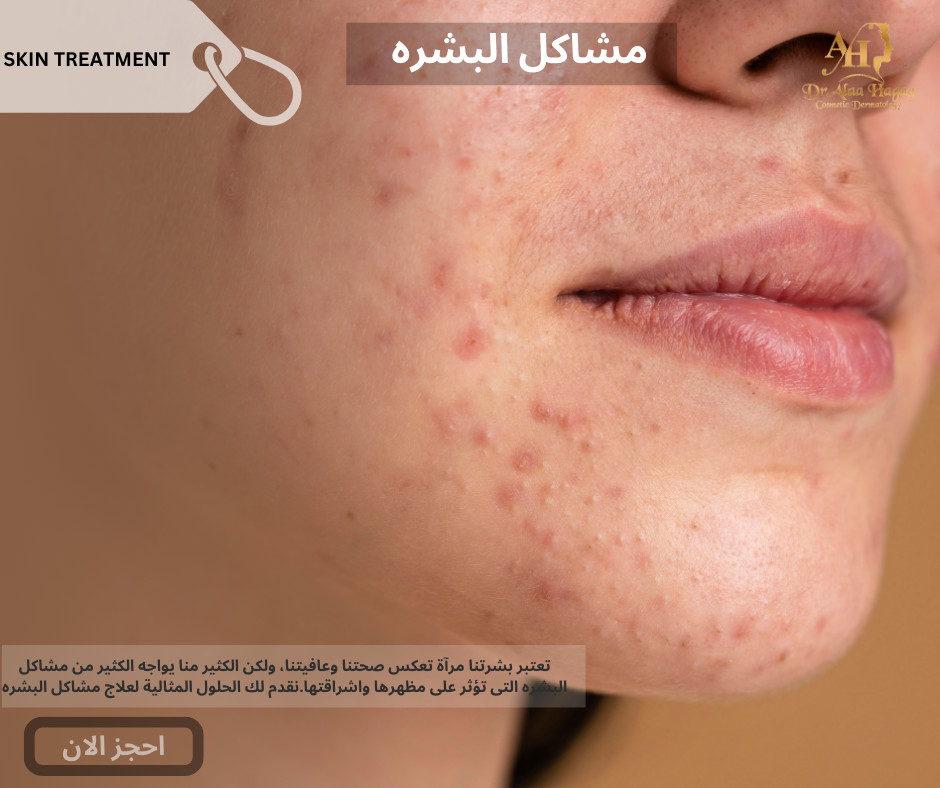 مشاكل البشره