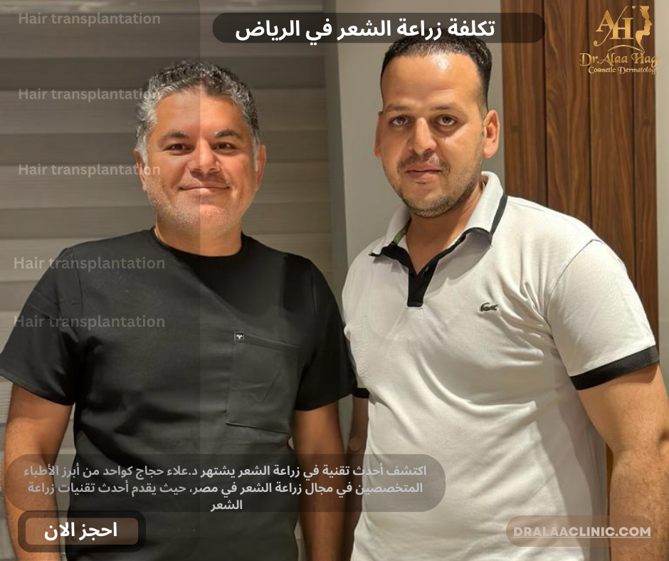 تكلفة زراعة الشعر في الرياض