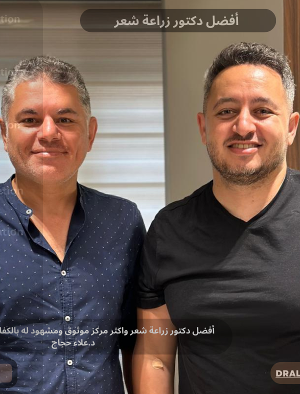 أفضل دكتور زراعة شعر