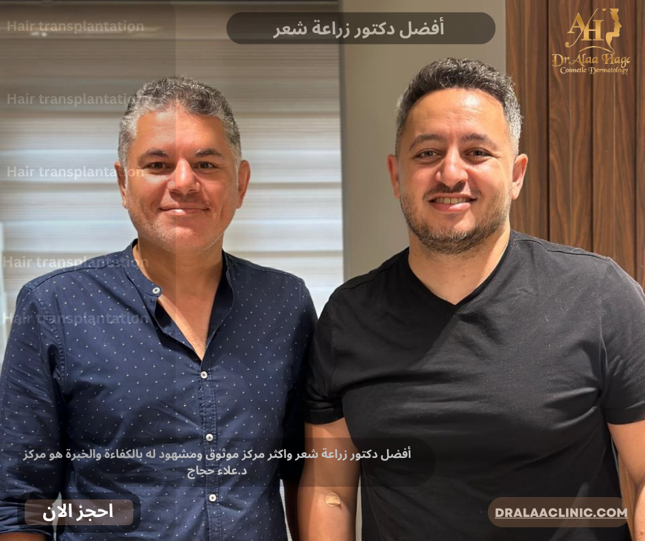 أفضل دكتور زراعة شعر