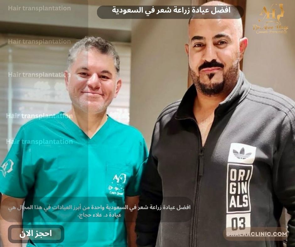 افضل عيادة زراعة شعر في السعودية