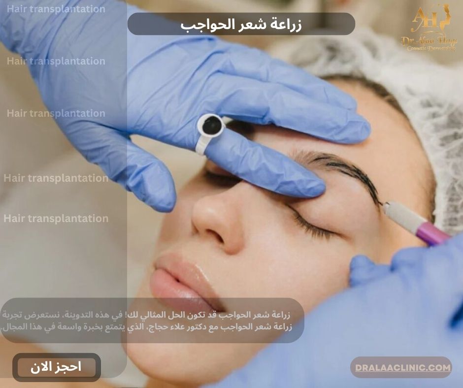 زراعة شعر الحواجب