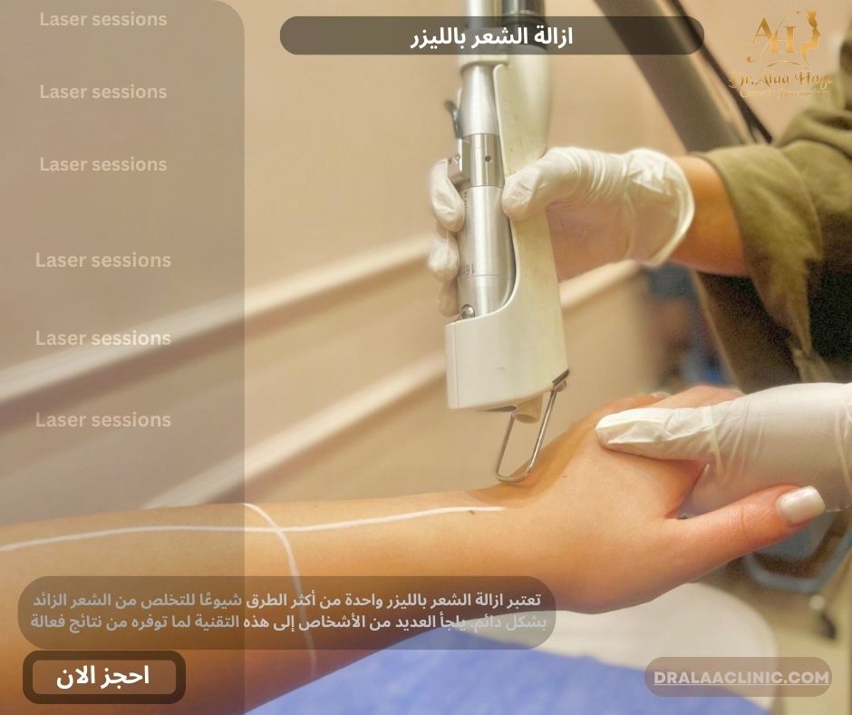 ازالة الشعر بالليزر
