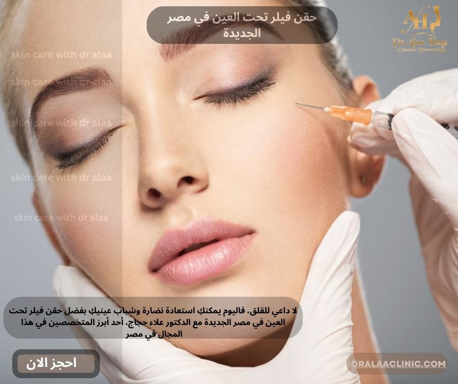 حقن فيلر تحت العين في مصر الجديدة