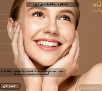 ازالة اثار حب الشباب من الوجه