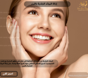 إزالة الزوائد الجلدية بالليزر
