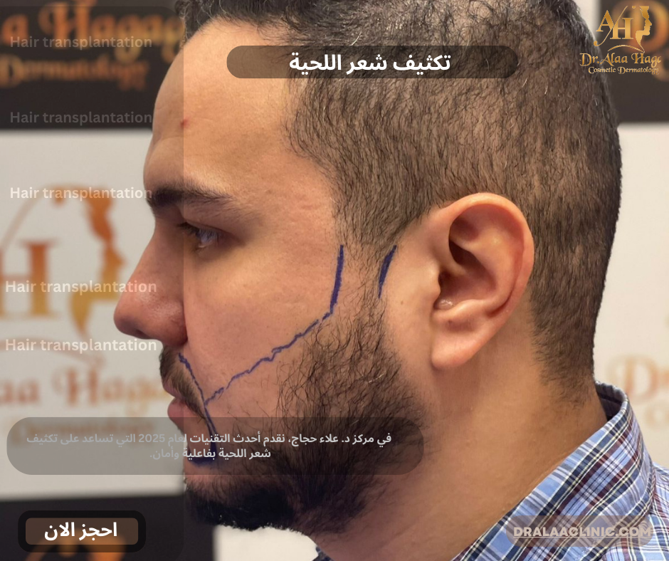 تكثيف شعر اللحية