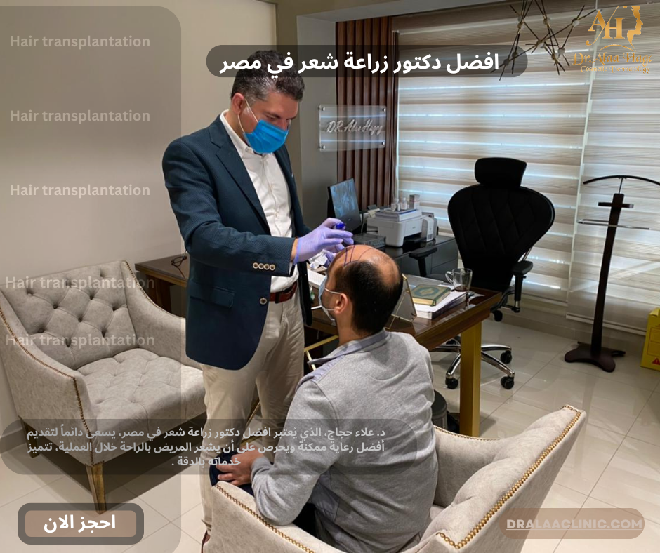 افضل دكتور زراعة شعر في مصر