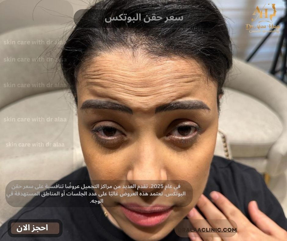 سعر حقن البوتكس