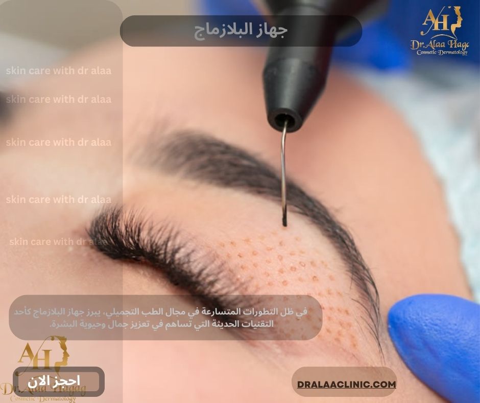 جهاز البلازماج