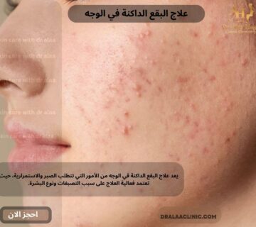 علاج البقع الداكنة في الوجه