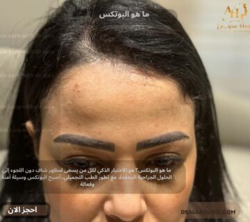 ما هو البوتكس