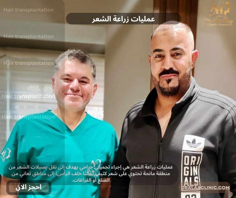 عمليات زراعة الشعر