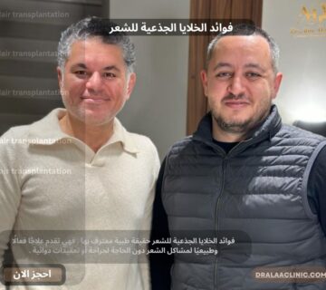 فوائد الخلايا الجذعية للشعر