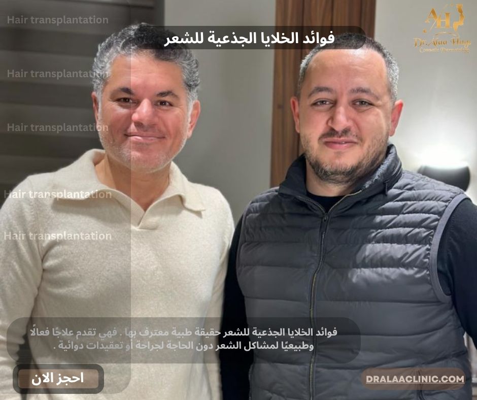 فوائد الخلايا الجذعية للشعر