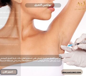 بوتكس التعرق