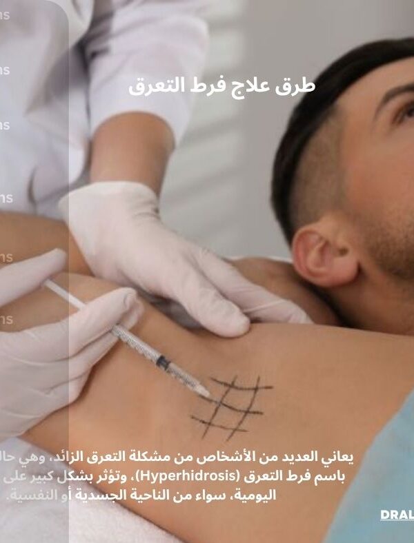 طرق علاج فرط التعرق