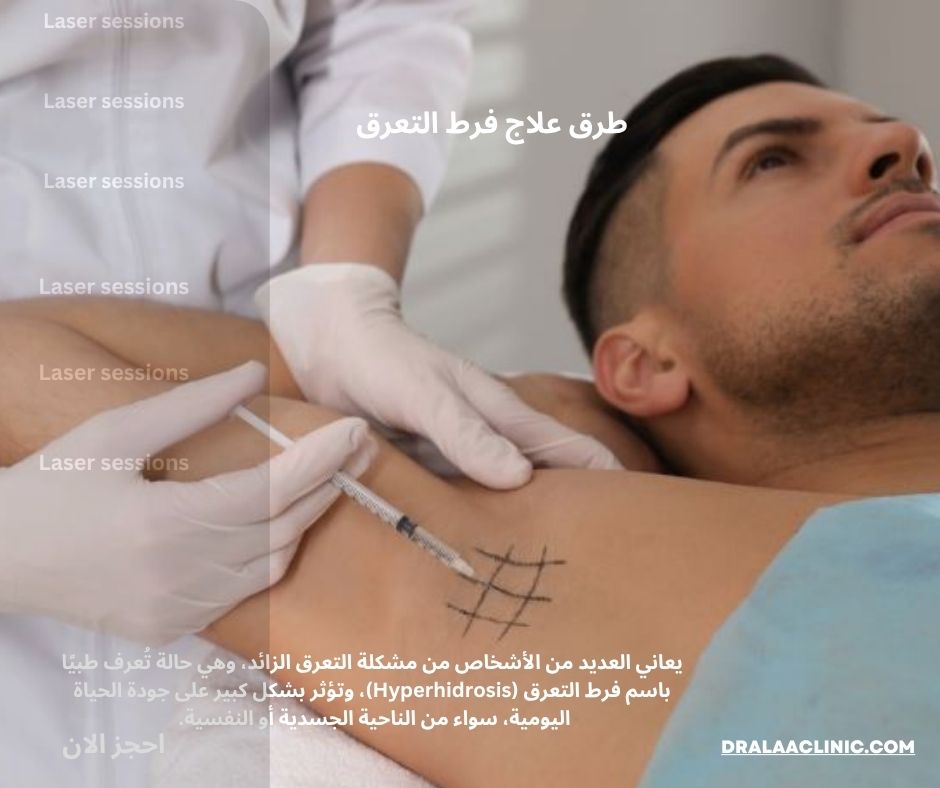 طرق علاج فرط التعرق