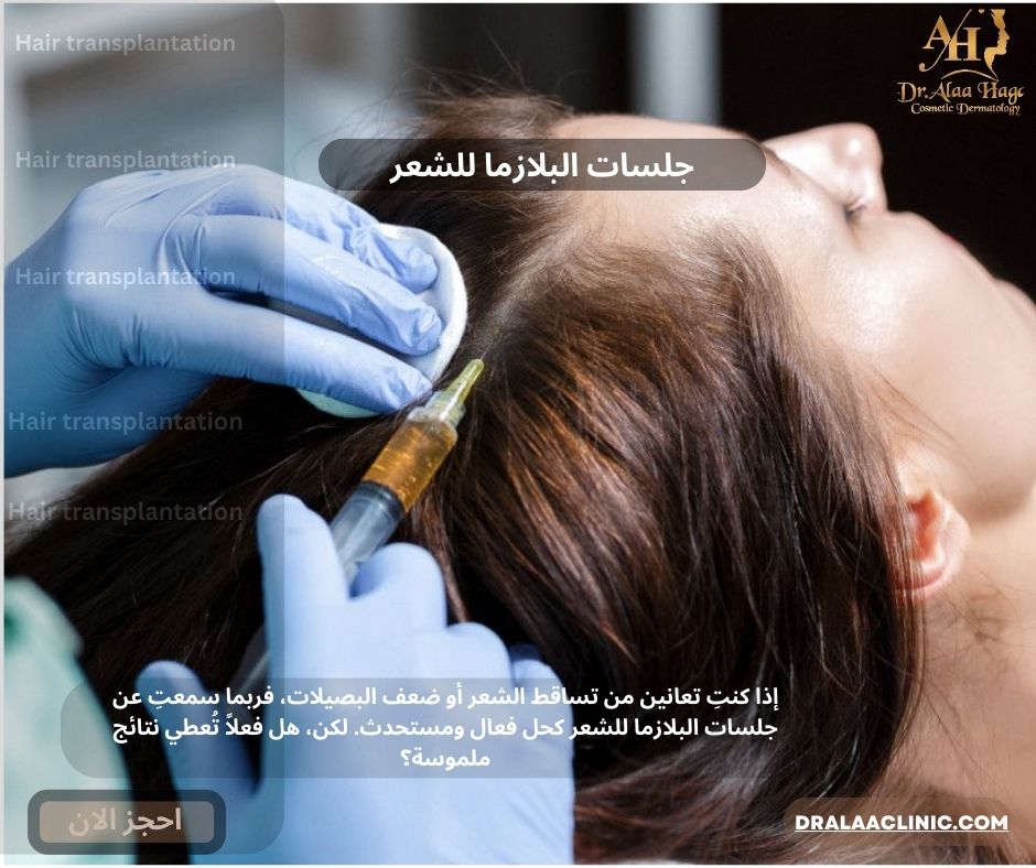 جلسات البلازما للشعر