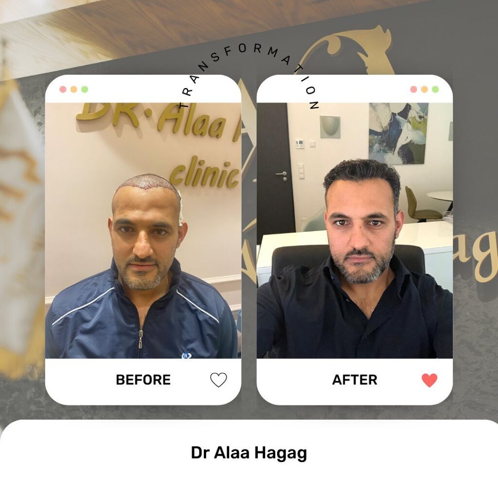 جلسات G Cell للشعر