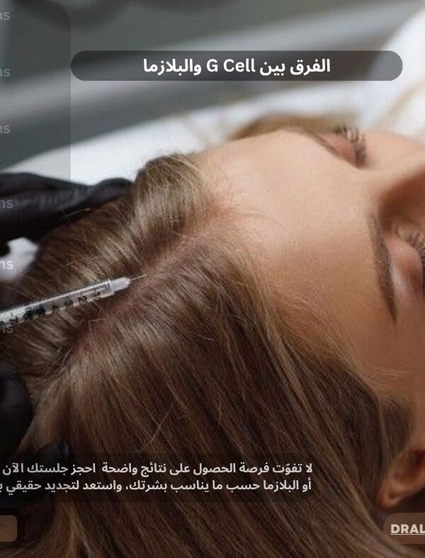 الفرق بين G Cell والبلازما